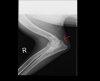 X-rays Right Elbow 042313.jpg